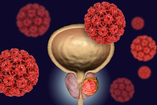 2025 ASCO：恩杂鲁胺联合 Lu-PSMA-617，改善 mCRPC 生存与生活质量